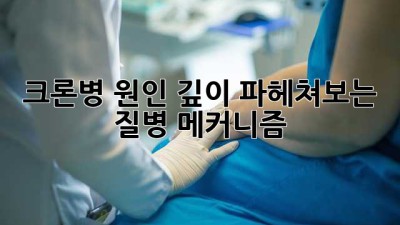 크론병 원인: 깊이 파헤쳐보는 질병 메커니즘